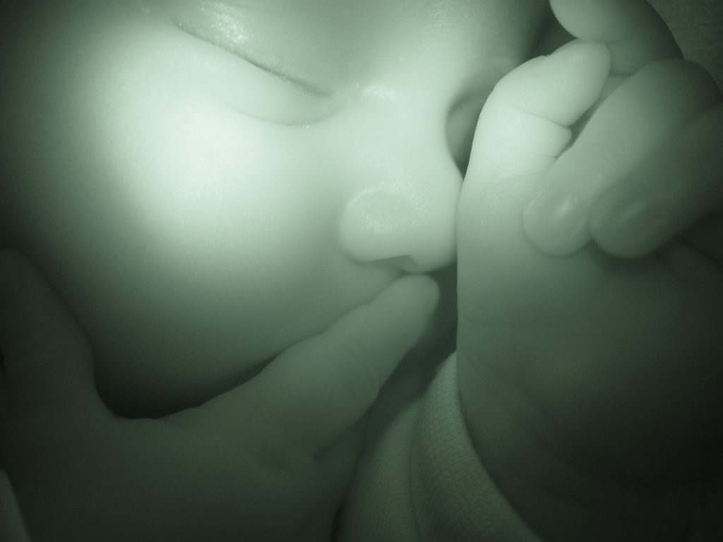 Pianto della figlia riporta in vita la madre in coma